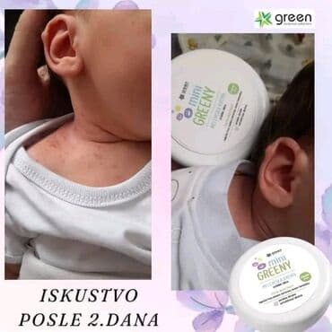 skidač šminke za osetljivu kožu: 🌿GREEN🌿 💚Mini Greeny - kolekcija za bebe i decu 💭 Dozvolite i vašem — 7
