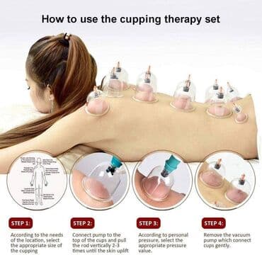 komplet za nokte: Ventuze . CUPPING-fizikalna terapija-akupunktura- čašama Komplet za — 10