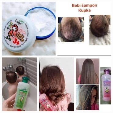 Other Children's Items: BEBI KREMA 🍭🍭🍭 Bebi krema sa cinkom, alantoinom i ekstraktom nevena — 6