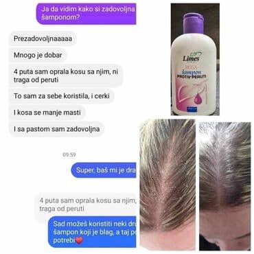 sophie's choice olovka za obrve: 🌸 Recite ZBOGOM peruti! 🌸 Isprobali ste sve, ali perut i dalje tu? 😕 — 3