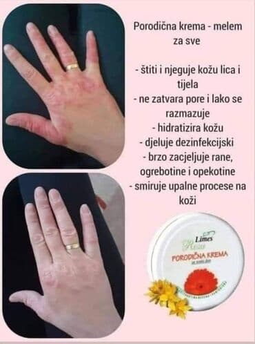 šminka za devojčice: Porodicna krema🌼🌼🏖🏖 Prva pomoc gde god da ste👌 Bez nje ne smete biti🍀 — 5
