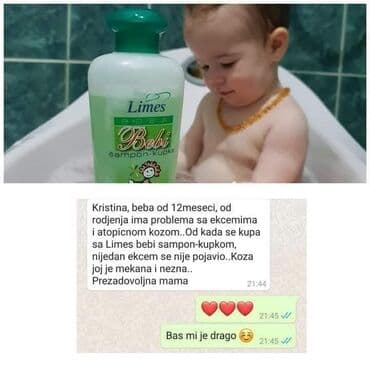Other Children's Items: BEBI KREMA 🍭🍭🍭 Bebi krema sa cinkom, alantoinom i ekstraktom nevena — 4