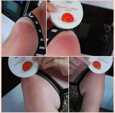 šminka za devojčice: Porodicna krema🌼🌼🏖🏖 Prva pomoc gde god da ste👌 Bez nje ne smete biti🍀 — 3