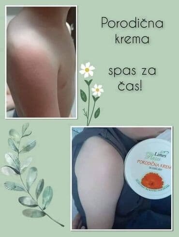 šminka za devojčice: Porodicna krema🌼🌼🏖🏖 Prva pomoc gde god da ste👌 Bez nje ne smete biti🍀 — 16