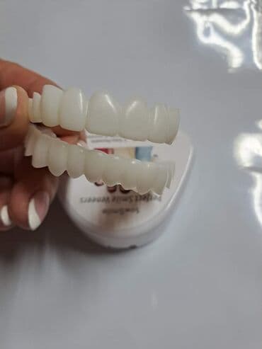 Ostalo: Snap on Smile navlake za zube
Cena:2100din/par — 5