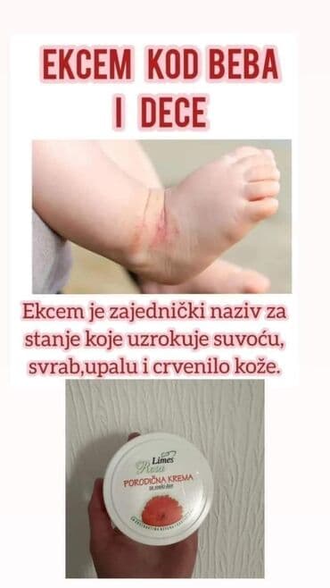 šminka za devojčice: Porodicna krema🌼🌼🏖🏖 Prva pomoc gde god da ste👌 Bez nje ne smete biti🍀 — 12