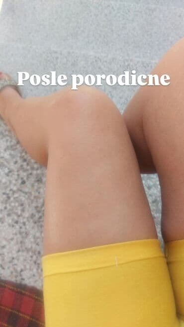 zenska licna nega: Preuzeto "Evo licno iskustvo sa porodicnom Juce na bazenu pocrvenim — 2