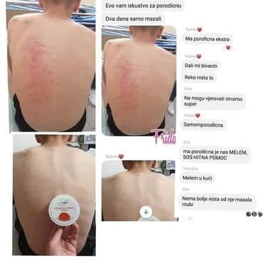 šminka za devojčice: Porodicna krema🌼🌼🏖🏖 Prva pomoc gde god da ste👌 Bez nje ne smete biti🍀 — 11