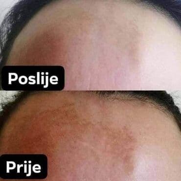 zenska licna nega: Iskustvo korisnice 🌹 Ovo je moje lično iskustvo sa Limes 21 kremom – — 6