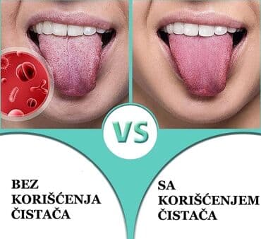 zenska licna nega: Metalni čistač jezika Tongue Scraper kreiran je tako da ga možete — 6
