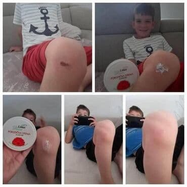 šminka za devojčice: Porodicna krema🌼🌼🏖🏖 Prva pomoc gde god da ste👌 Bez nje ne smete biti🍀 — 13