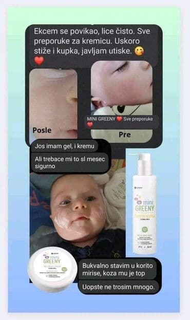 skidač šminke za osetljivu kožu: 🌿GREEN🌿 💚Mini Greeny - kolekcija za bebe i decu 💭 Dozvolite i vašem — 4